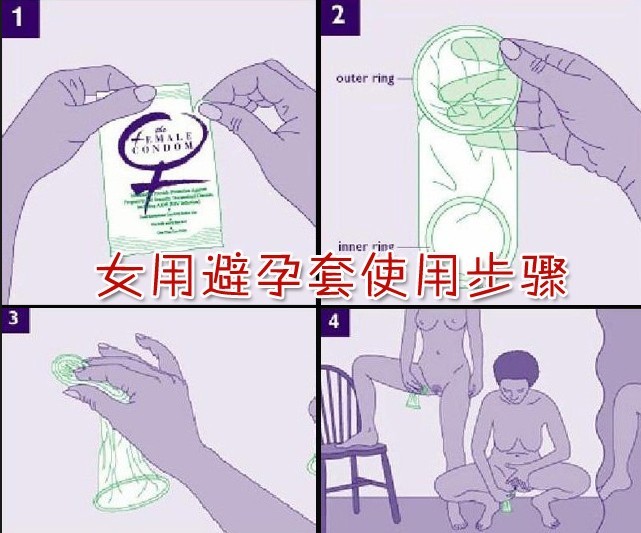 女性避孕套是什么原理_避孕套蓝色是什么牌子