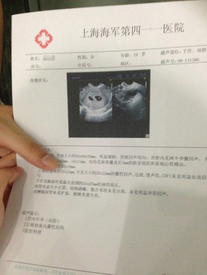 19岁少女人流前晒图:舍不得双胞胎