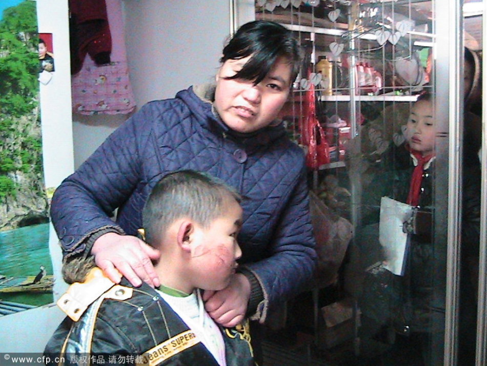 幼教老师易某用电熨斗烫伤7名幼儿的脸_雪里