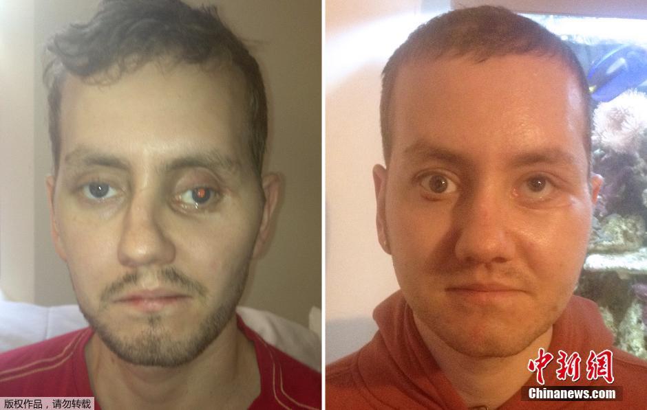 广州恒大vs墨尔本