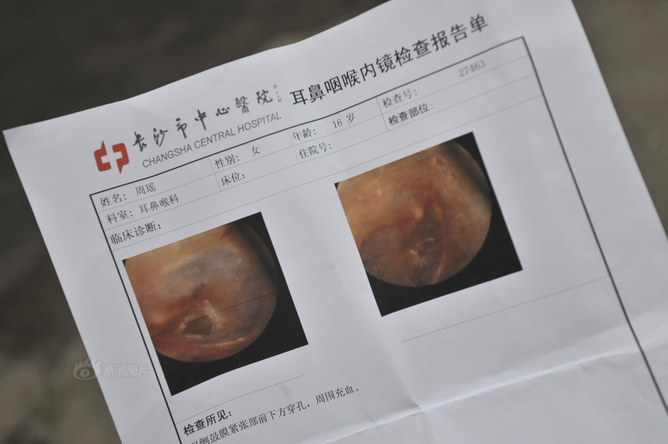 <em>长沙</em>一中专16岁女生遭同学群殴并拍裸照,<em>长沙</em>