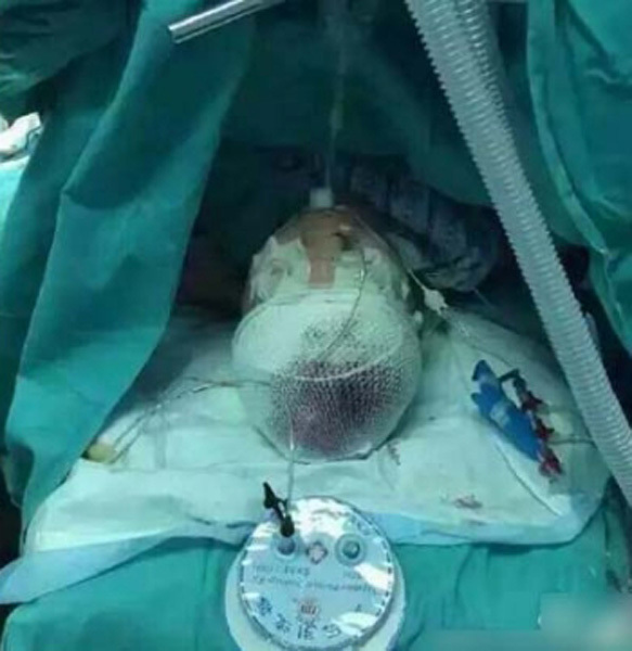 昆明附一医院护士遭男子砍伤