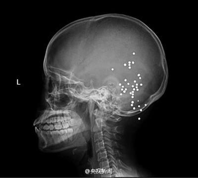 青岛直播-乐鱼app(leyu)官方网站-乐鱼官网