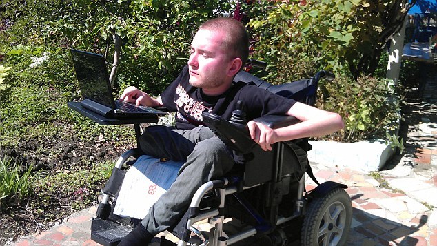 惊呆!外科医生称 成功 为 猴子  换头 _扬子晚报网