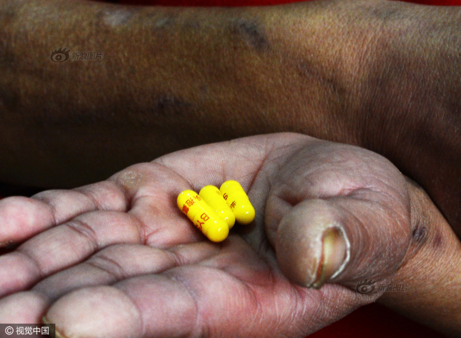 几年前胳膊上出现很多针眼大小的血点有突出