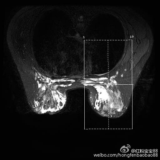 50人群体交乱