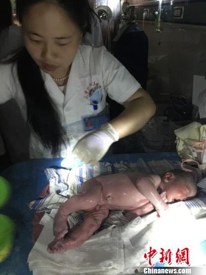 黄色 视频 观看