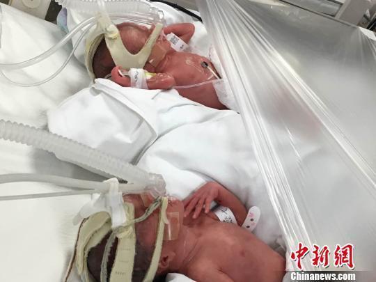 Www黄色免费网站