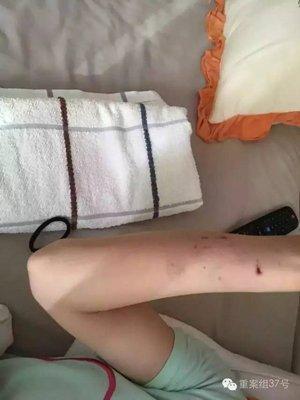 女按摩師