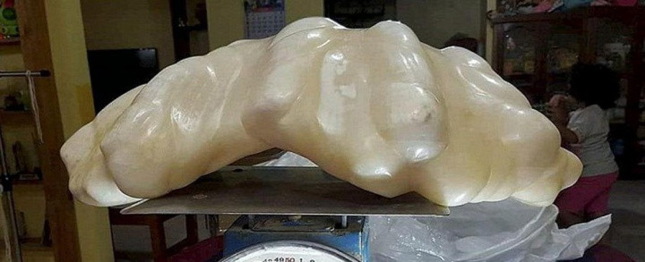 小姨媽