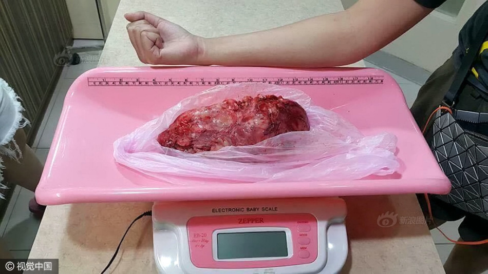 校花被 出乳白色液体软件