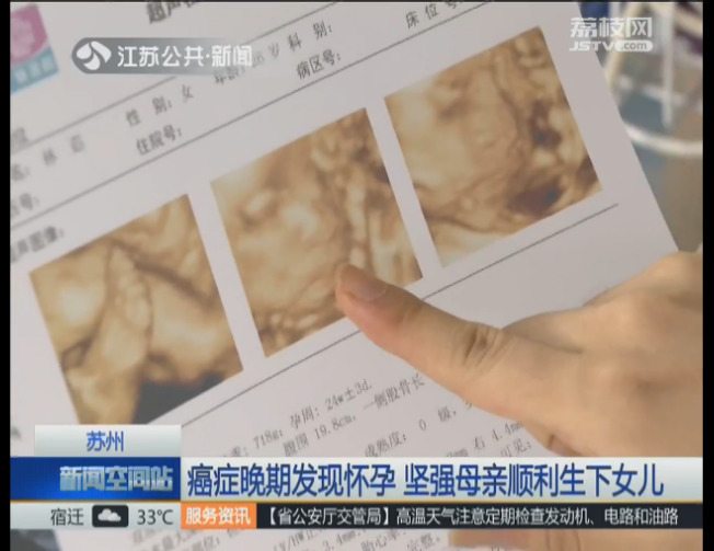 国产愉拍91九色国产愉拍