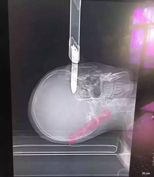 亚洲老熟女Tubeumtv电影