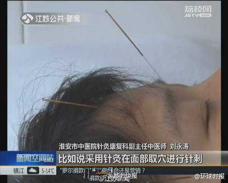 快手直播