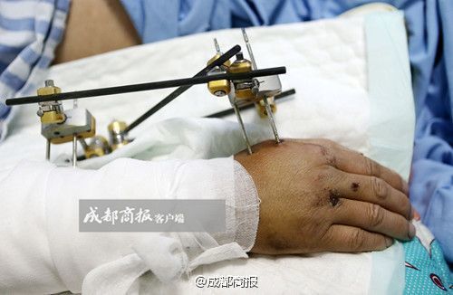 国产 肥老妇 九色