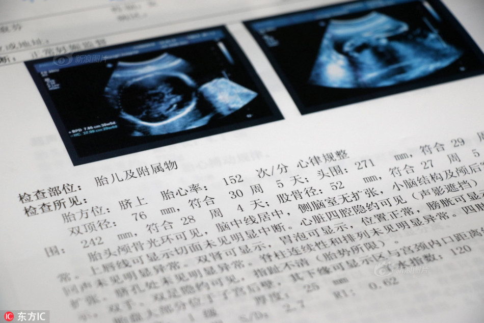老妇女水多毛多Bbbbb