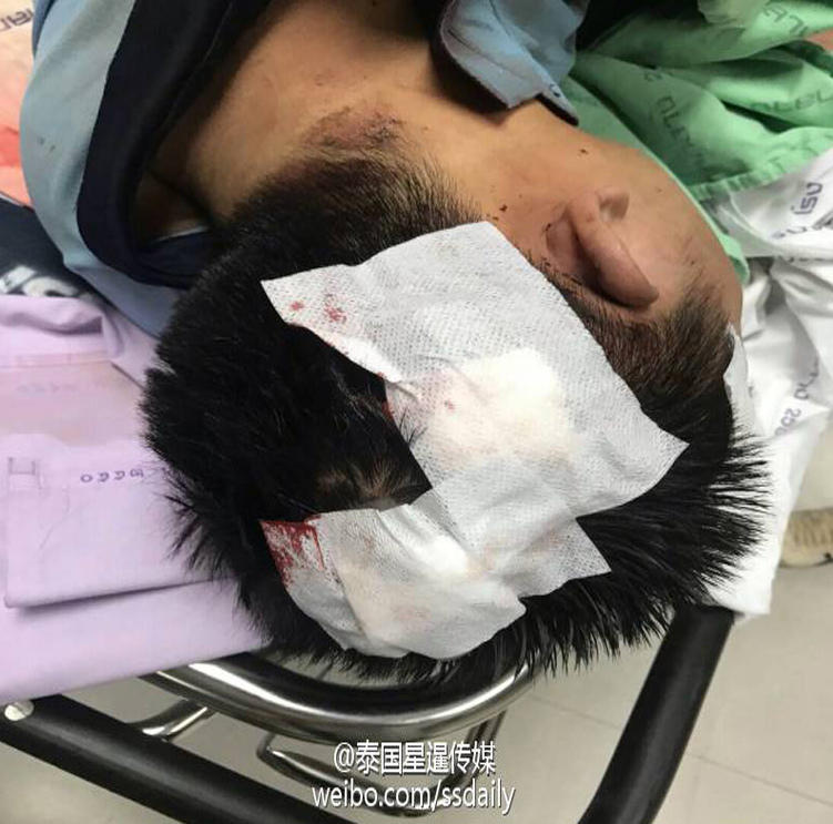 百度百度下载一个三级黄片欧美的最新的