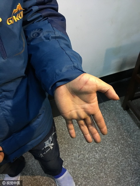 日本亲子伦孑