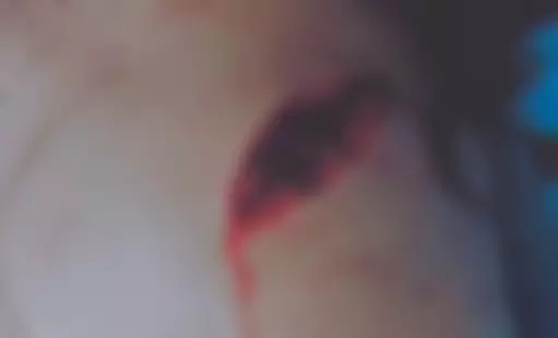 老总被砍_祁可欣被砍图片(3)