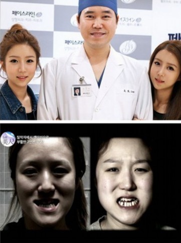 韩国面部畸形双胞胎 整容逆袭成女神