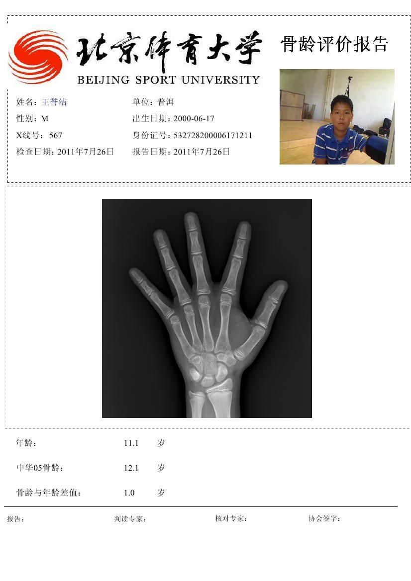 全国青少年足球联赛普洱骨龄检测结果公示