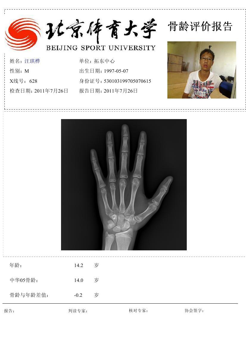 全国青少年足球联赛拓东中心骨龄检测结果公示