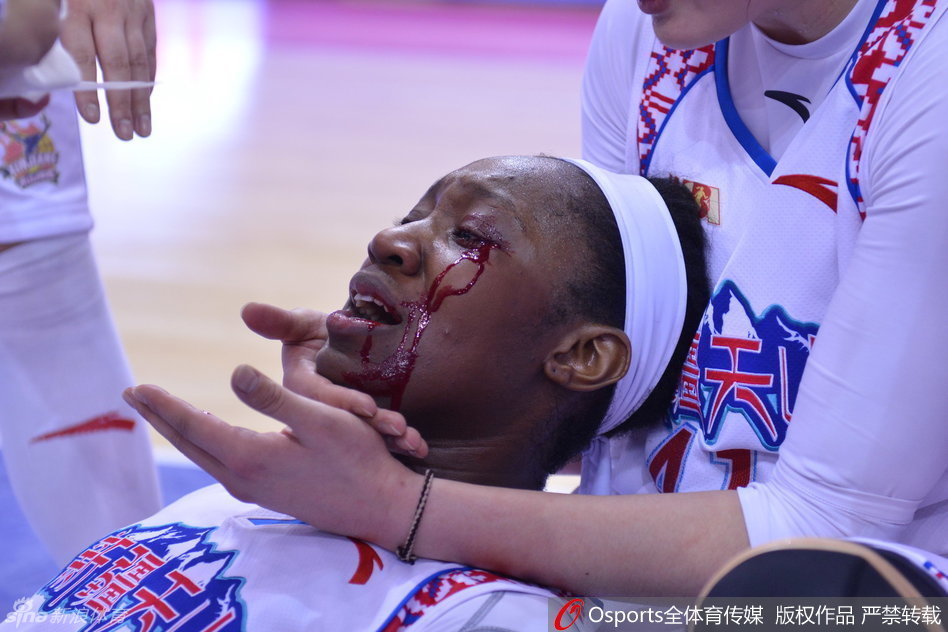 赛场地板上的血迹触目惊心，见证了这场总决赛的残酷与惨烈，也见证了查尔斯战斗到最后一刻的英勇。