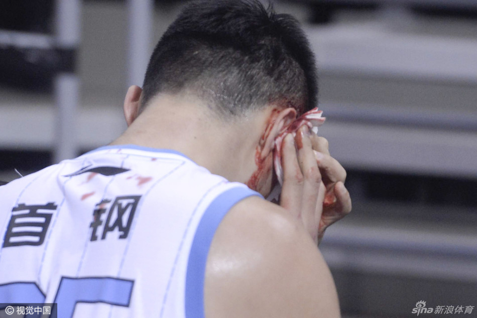 张松涛戴着白色保护头套坐在场边，与队友孙悦有说有笑，心情轻松