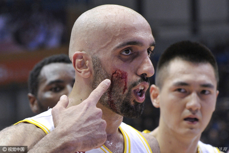 阿巴斯被张松涛肘击瞬间，身体失衡倒地，表情痛苦，场上气氛骤然紧张。