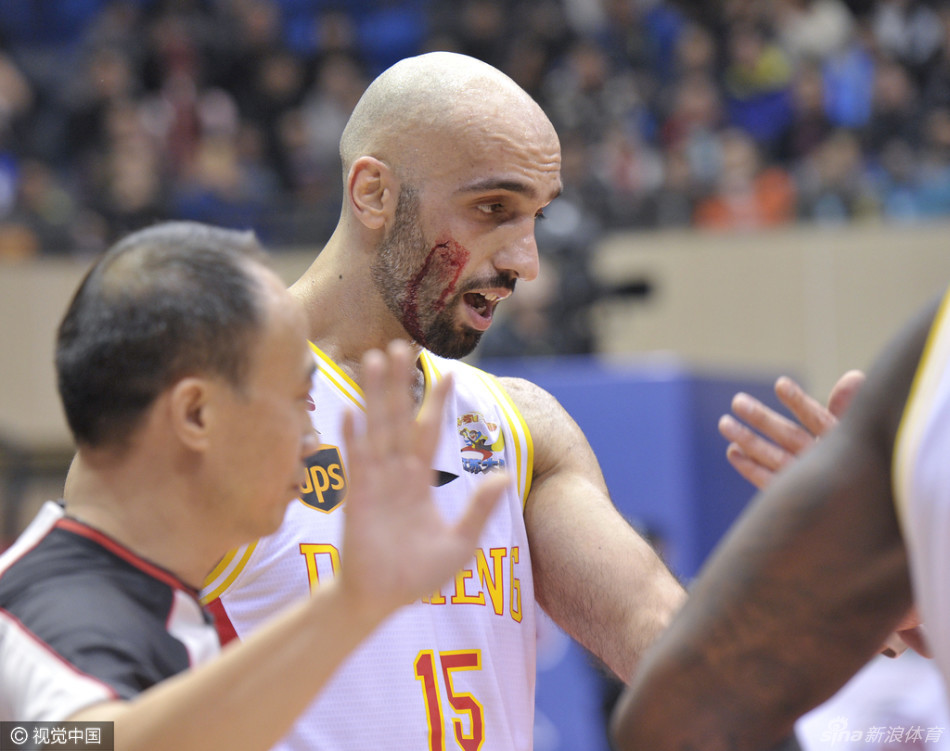 下半场阿巴斯带伤上阵，眼角贴着醒目的胶布，在比赛中依然奋力拼抢。