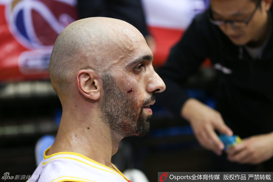 阿巴斯在队友搀扶下起身，指着自己流血的脸部，愤怒地向裁判展示伤情并要求公正判罚。