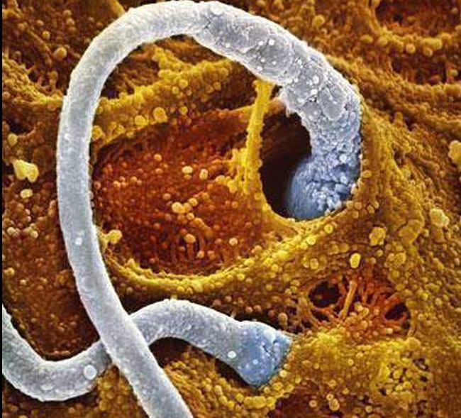 精子窝最新人口_纸上精子正常图(2)