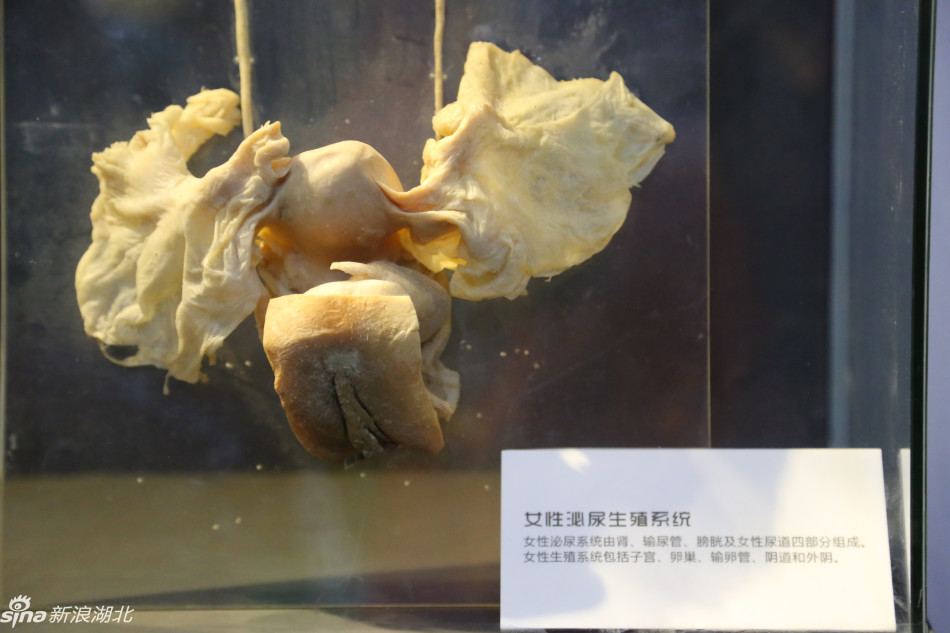 该展展出了17具完整的人体标本,近200件人体器官标本,全部来自真实