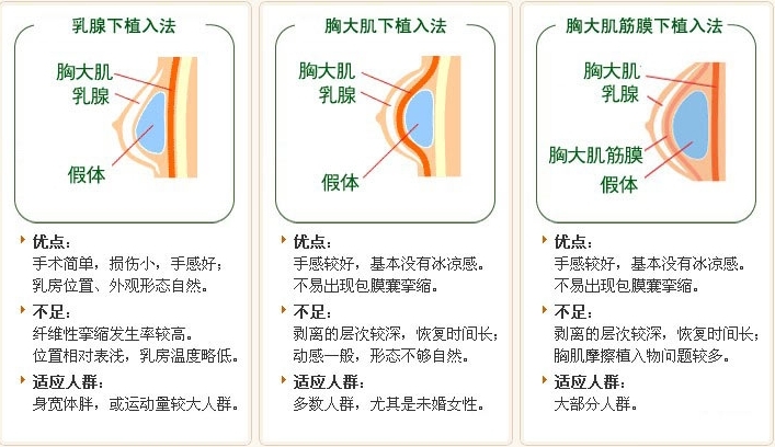 震撼实拍国外美女隆胸手术全过程