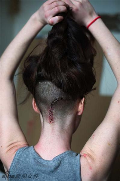 外国摄影师镜头 记录<em>吸毒女孩</em>的美丽蜕变-顺德