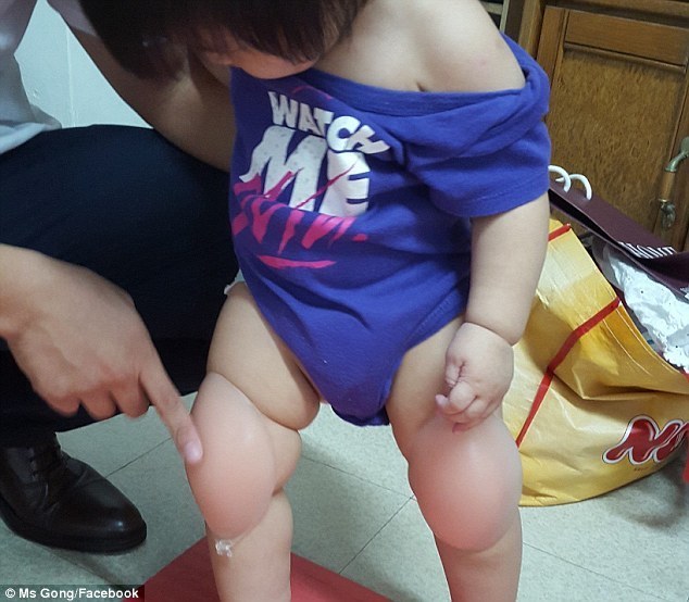 内衣做护膝_旧袜子做护膝图片大全