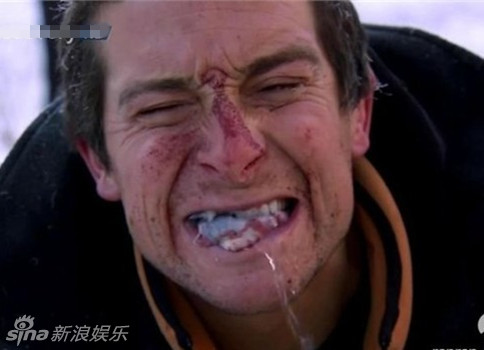更有落选港姐身穿超短护士装抛胸露底