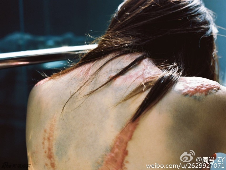 组图:烧伤女孩周岩旧照甜美清纯 性格坚强阳光_高清图集_新浪网