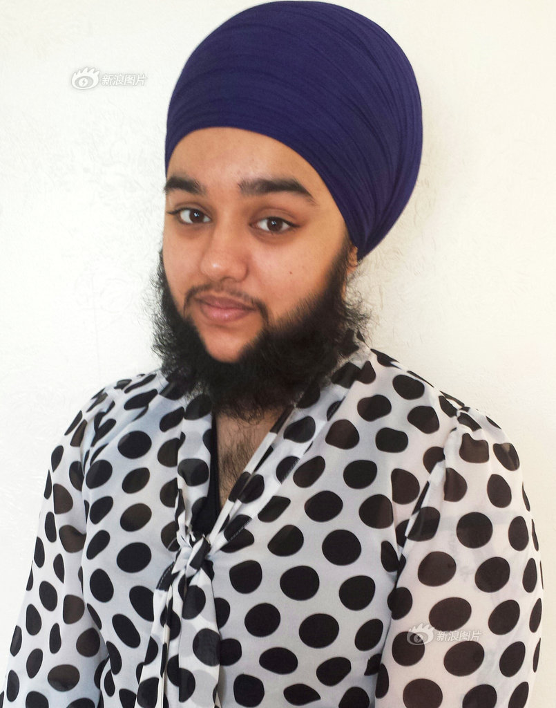 不喜欢络腮胡,脸上汗毛多,长、腿上也重,我如何