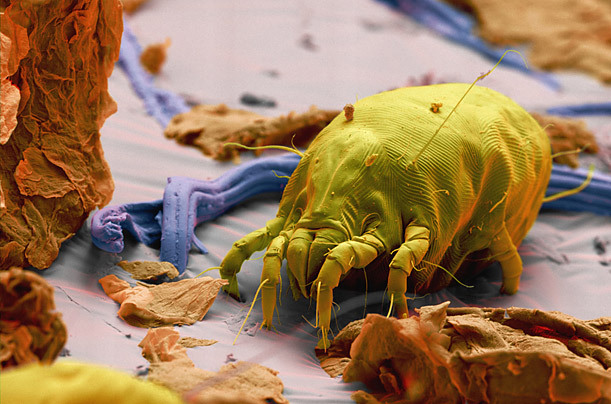 高倍显微镜下的昆虫狰狞“证件照”