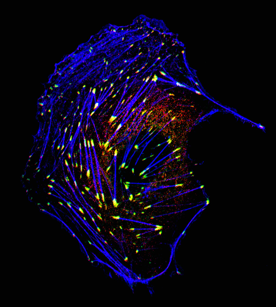 显微镜下的生命之美:正分裂细胞藕断丝连_天津在线