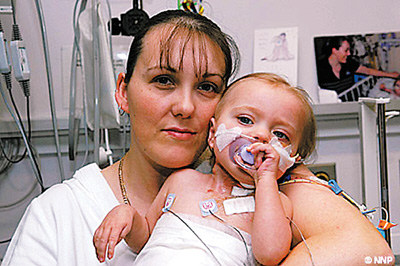 英国岁半女孩六死六生 急需移植心脏