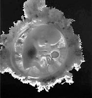 英国原则同意人兽混合胚胎实验
