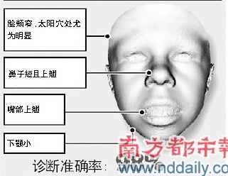 相面软件辨脸识病