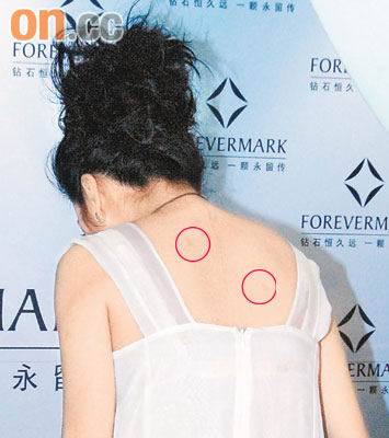 赵薇飘逸白衣不合身 露<em>文胸</em>边及<em>背部</em>疤痕(图)_