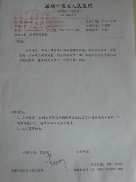 鼻窦骨折ct报告