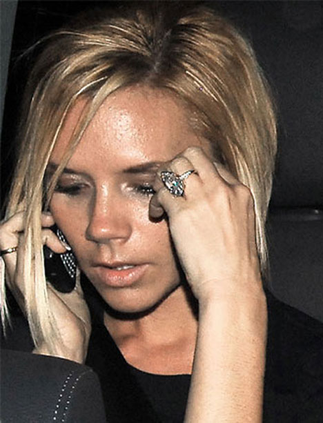 维多利亚拍写真被粉刺困扰 满头全是小疙瘩(图