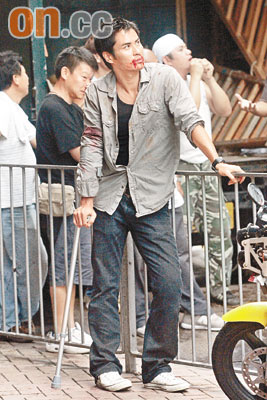 郑嘉颖拄拐杖开工 扭伤当好兆头抬高收视【图】