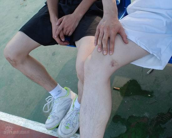 真男篮球对抗赛“李俊基”贾寅寅出意外【图】