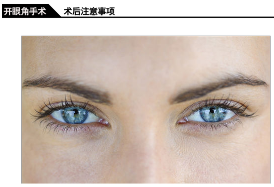 术后注意事项